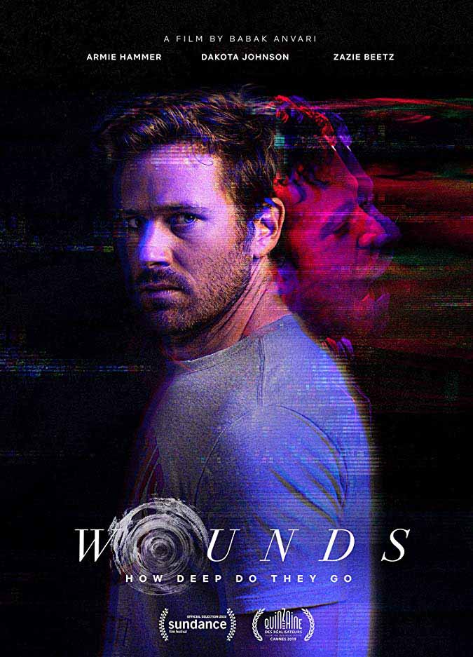 wounds wounds